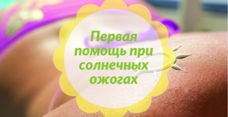 Первая помощь при солнечных ожогах