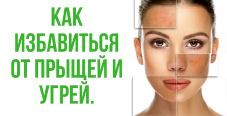 Как избавиться от прыщей и угрей