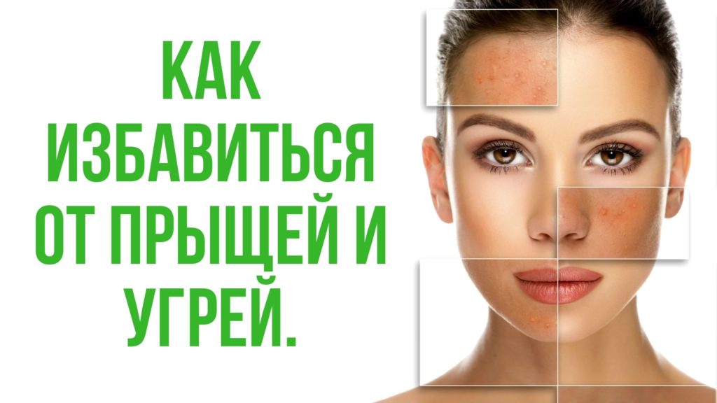 Блог Как избавиться от прыщей и угрей