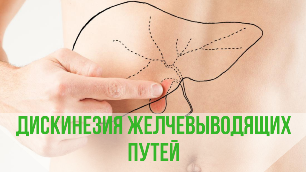 Блог Дискинезия желчевыводящих путей