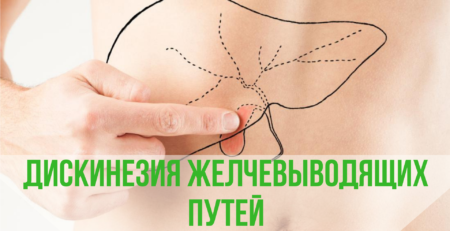 Дискинезия желчевыводящих путей