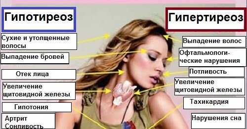 Щитовидная железа