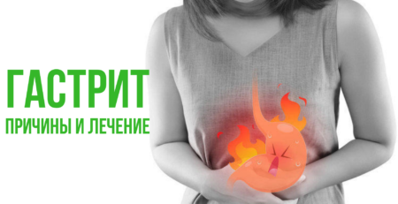 Гастрит