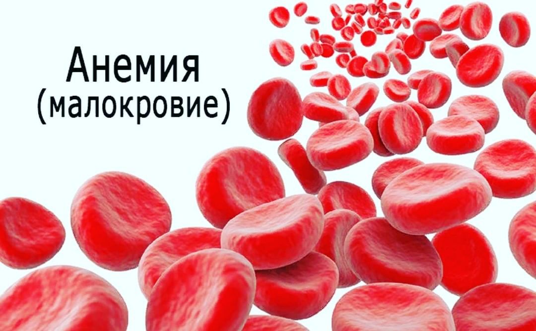 Как повысить гемоглобин