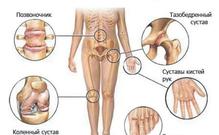 3_575ff59d3eb89-min Самые эффективные способы оздоровить суставы