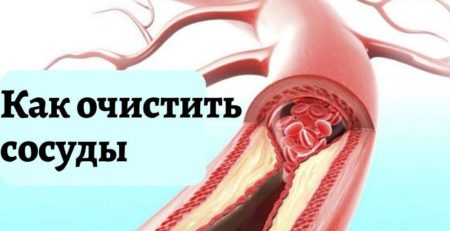 Очищение сосудов народными средствами