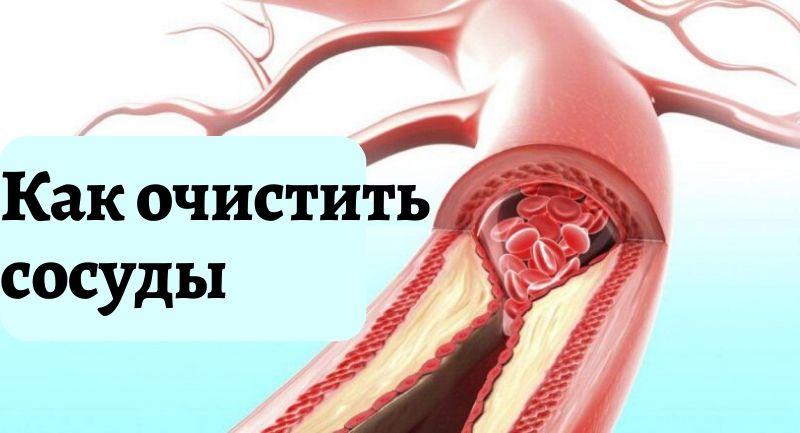 Блог Очищение сосудов народными средствами